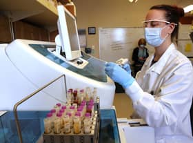 Medical laboratory scientist, Aniela Sobel, tests serology samples from the Novavax phase 3 Covid-19 clinical vaccine trial (Photo by Karen Ducey/Getty Images)
