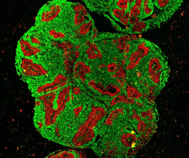 Pictured here is a one-month old brain organoid of a rhinoceros. In this microscopic cross-sectional image, progenitor cells of neurons can be seen in red. Fully developed neurons are colored green. 