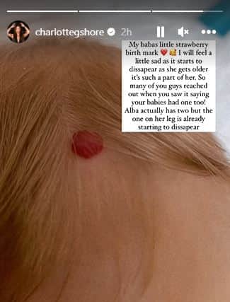 Charlotte Crosby shared daughter Alba’s birthmark (Instagram/charlottegshore)