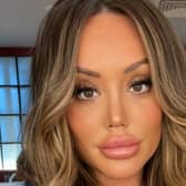 Charlotte Crosby has reflected on her previous lip filler procedures. (Picture: Instagram/@charlottegshore)
