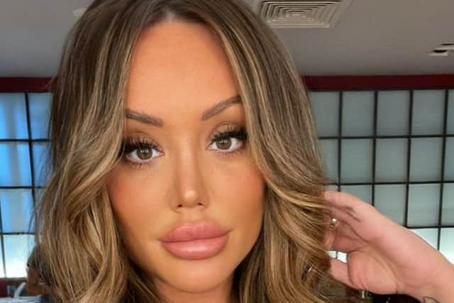 Charlotte Crosby has reflected on her previous lip filler procedures. (Picture: Instagram/@charlottegshore)