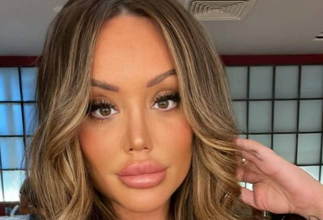 Charlotte Crosby has reflected on her previous lip filler procedures. (Picture: Instagram/@charlottegshore)