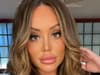 ‘I looked ridiculous’: Charlotte Crosby vows to ‘never’ go back to having big lips after removing filler