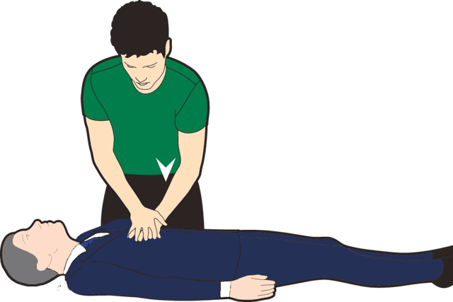 Delivering CPR