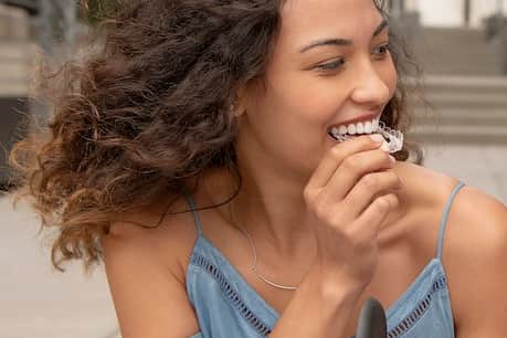 Invisalign aligners being attached.