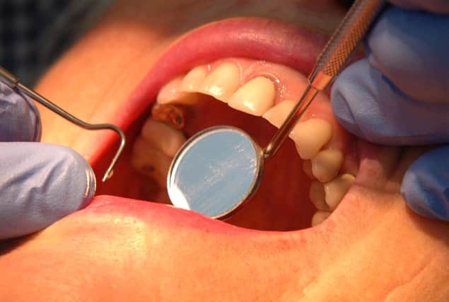 Checking condition of teeth with a visit to the dentist.