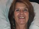 Linda Davis, 71, was in Southwell Road East, Rainworth, when she was hit by a privately-owned electric scooter.