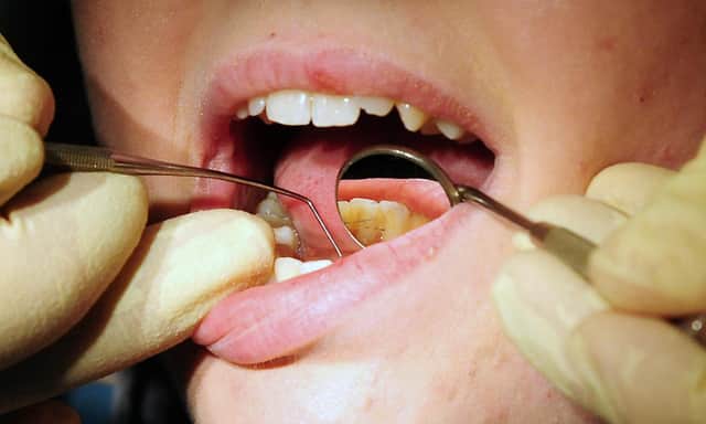 File photo dated 19/05/11 of a dentist at work. People in the UK have been forced to pull out their own teeth at home because they can not access or afford an NHS dentist, a damning new report from the Health and Social Care Committee has found.